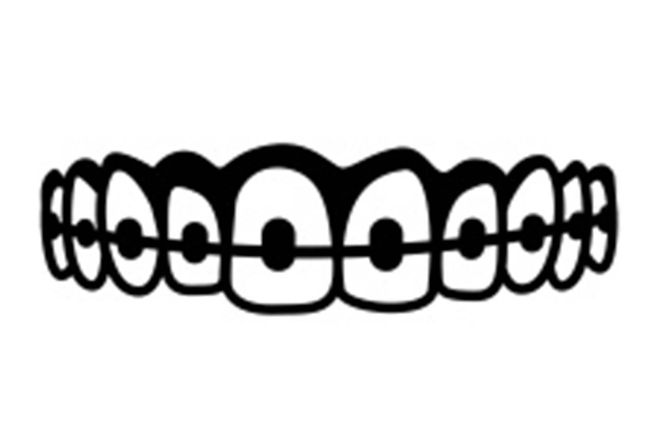 Playing saxophone or clarinet with braces - Syos